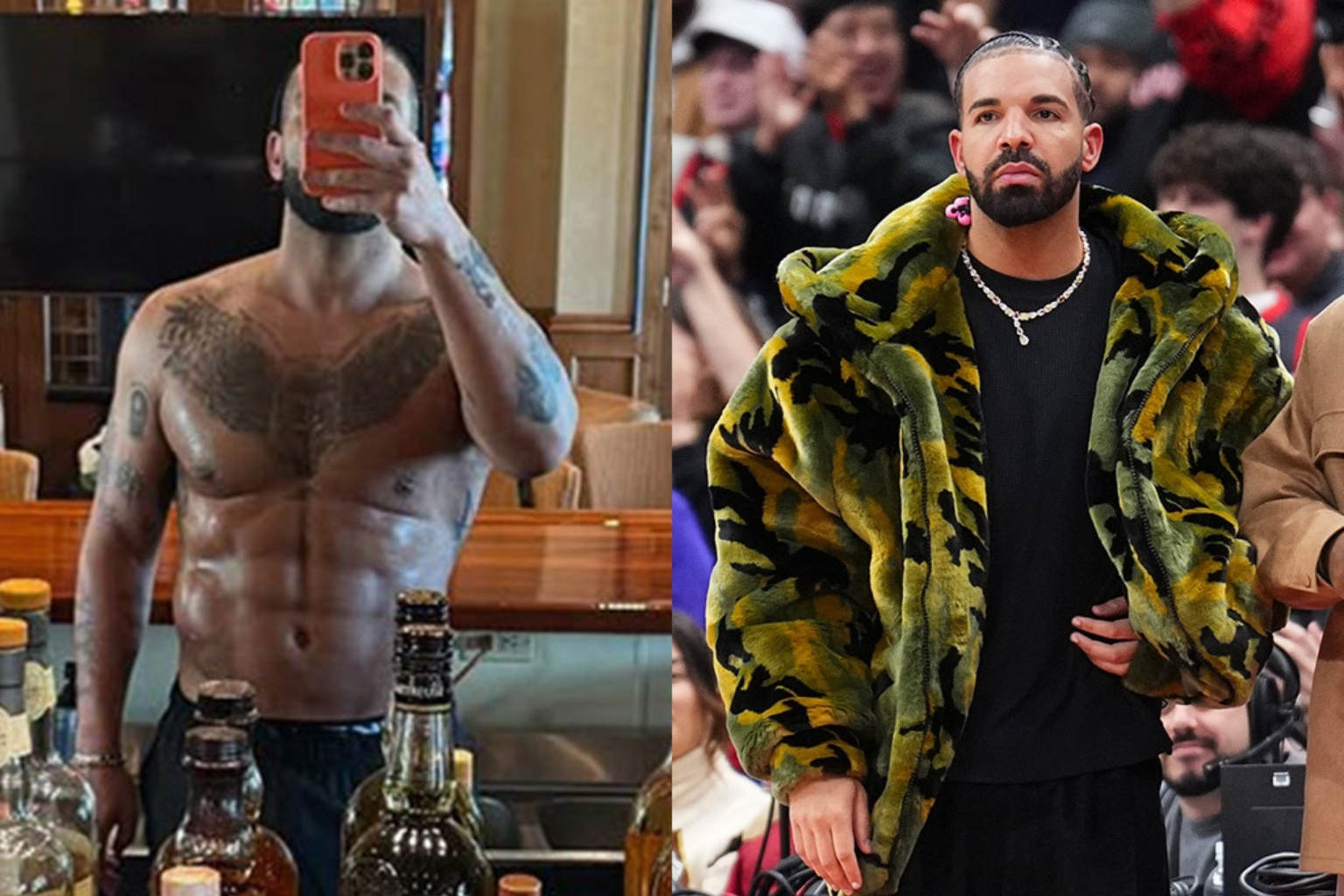 Drake Addresses AB Surgery and BBL Rumors